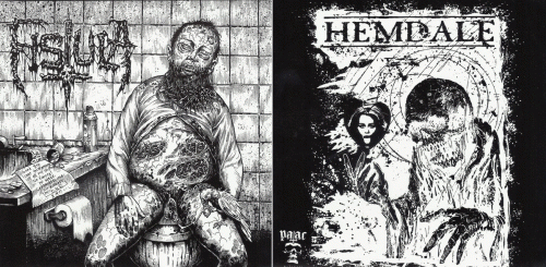 Fistula (USA-1) : Fistula - Hemdale